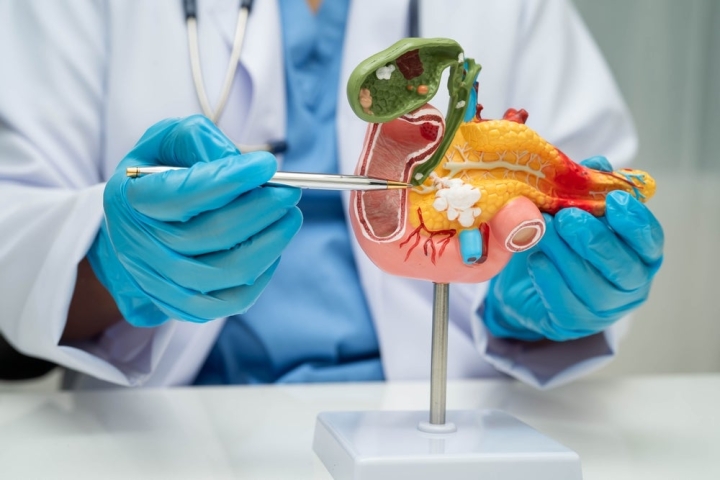 Immuneering расширяет клинические испытания атебиметиниба при раке поджелудочной железы и НМРЛ