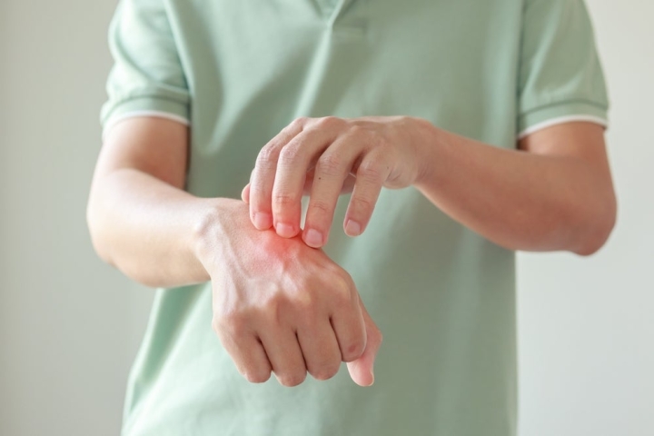 Nemluvio® Galderma демонстрирует быстрые результаты и большой коммерческий потенциал